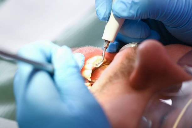 Best Cosmetic Emergency Dentistry in Cherry Grove, OH